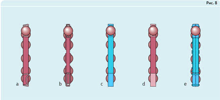 Сепараторы: a, b - штампованный, сталь; c - цельный обработанный, латунь; d - цельный обработанный, сталь; e - составной обработанный, латунь.